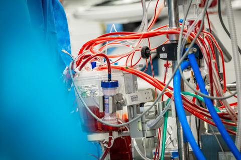Pediatric heart transplant