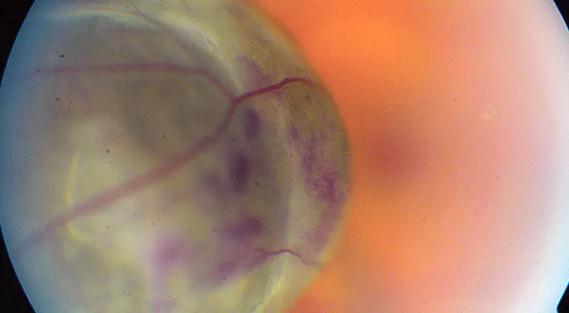 690&#215;380-Blood-Biomarkers