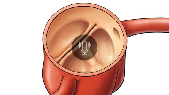 two-cusp heart valve with a podcast button overlay