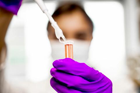 650&#215;450-Prostate-Cancer-DNA-Precision-Medicine