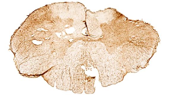 pathology slice of human spinal cord