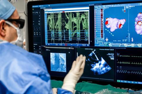 physician watching monitor screens during an electrophysiology procedure
