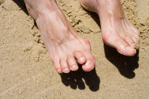 feet with hammertoe affliction
