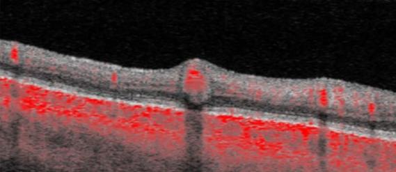Layers of the retina highlighted in red