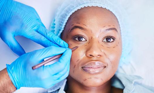 Surgical-gloved hands making plastic surgery marks on a person's face