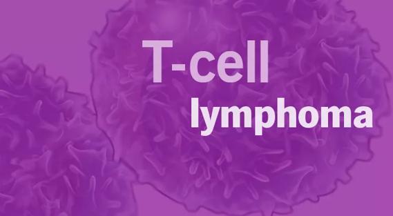 cancer t-cell lymphoma