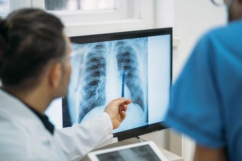 Doctor looking at chest x-ray