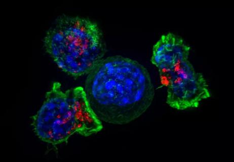 killer-t-cells-surround-a-cancer-cell_650x450