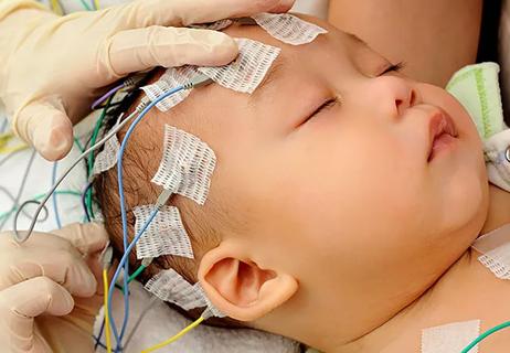 22-NEU-2832861-epilepsy-evaluation-in-infant-650&#215;450