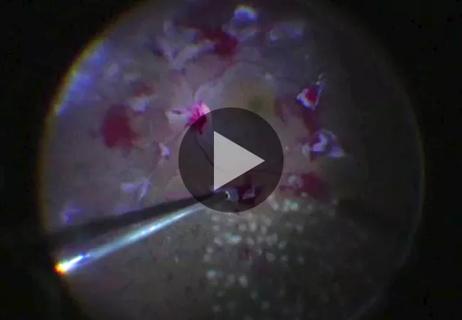 18-EYE-1150_HeroVideo