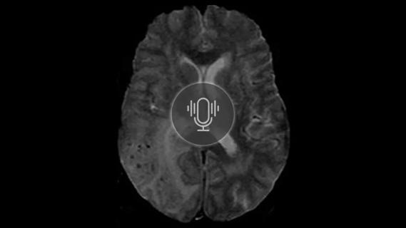 inflammation on a brain scan with a podcast button overlay