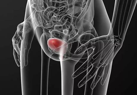 650&#215;450 Pelvic-stimulation