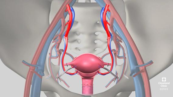 16-OBG2467-UterineTransplant-650×450
