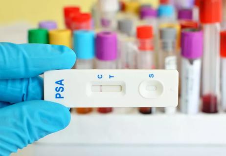 Gloved hand holds a Prostate-Specific Antigen Test