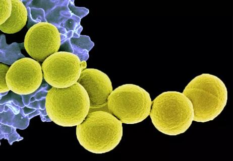 Staphylococcus aureus organism