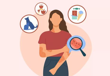 Person with rash surrounded by circles featuring small illustrations of food, pets, and plants