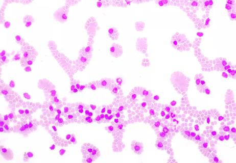 CLL