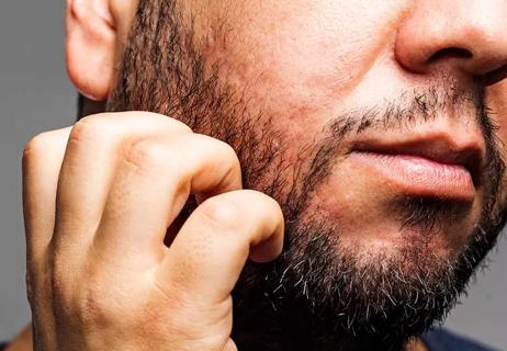 Closeup of person itching their beard.