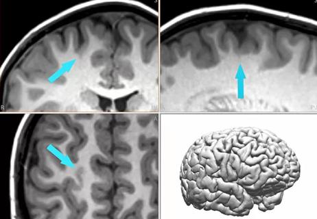 four imaging studies of the human brain