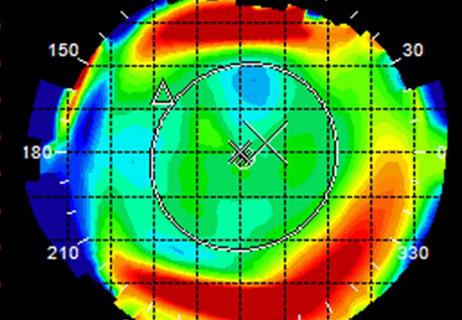 21-EYE-2084160-CQD-Topography-Pattern-Recognition-Analysis