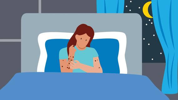 Person sitting up in bed at night scratching at eczema on their arm