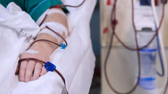 Patient's arm connected to dialysis IV