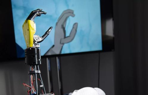 21-NEU-2323811-neurorobotic-prosthetic-arm-650&#215;450
