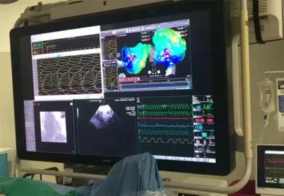 20-HVI-1885877-bailout-ventricular-ablation-650&#215;450