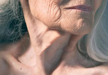 Elderly neck with wrinkles and sagging skin.