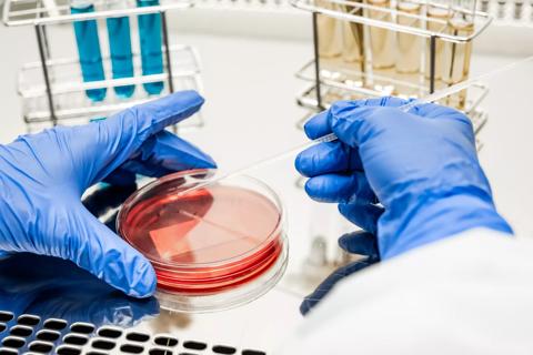 Researcher working with petri dish