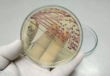 Culture and Sensitive test with urine specimen on Hi chrome, UTI agar medium at medical microbiology laboratory.
