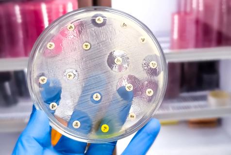 laboratory image of antibiotic susceptibility test