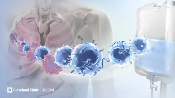 Cancer - Cleveland Clinic