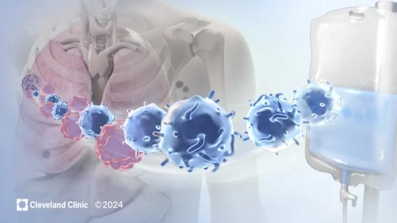 Tumor-Infiltrating Lymphocytes (TIL) therapy