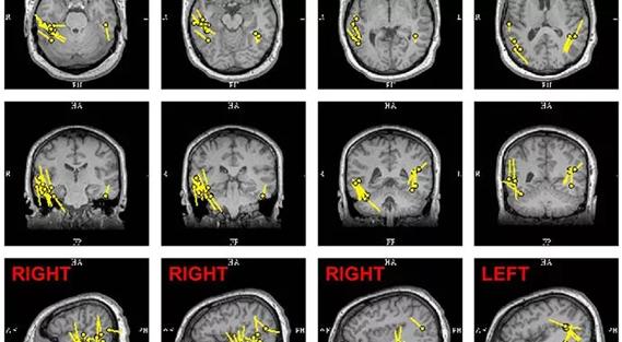 Case-Study-690&#215;380