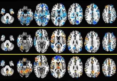 650&#215;450-fMRI-Study