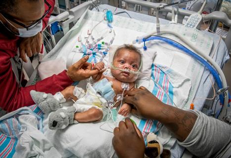 Baby with CHD