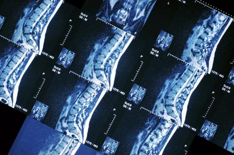 Spine