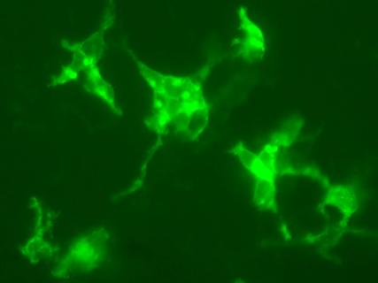 Slide images of membrane of endothelial cells.