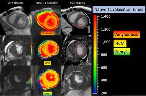 Cardiac Imaging