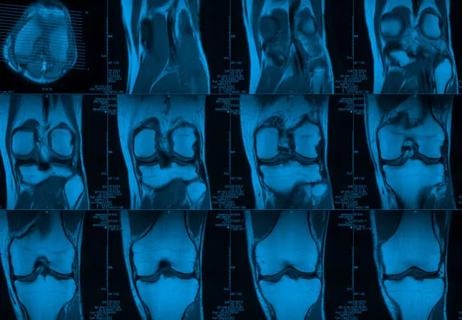 19-ORT-1188-Musculoskeletal-CQD