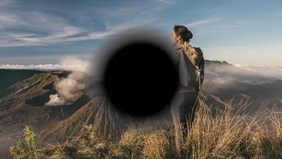 Macular degeneration