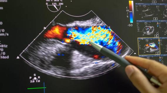 Ion: Technology and Techniques for Shape-sensing Robotic-assisted