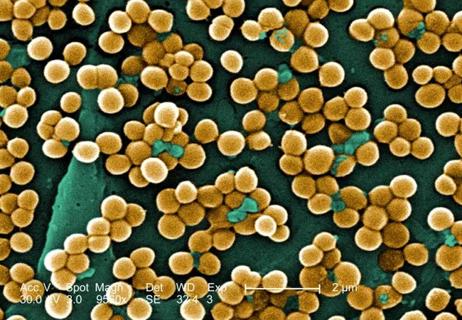 methicillin-resistant staph organisms