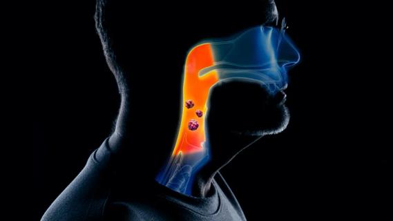 Head and neck cancer illustration
