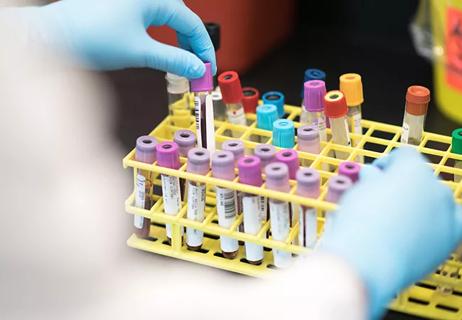 Blood Vials Being Placed in a Rack stock photo