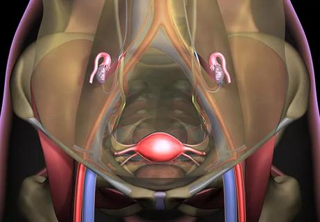 Ovarian Transposition: A Surgical Option for Fertility Preservation