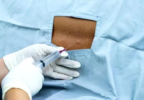 Patient getting a nerve block