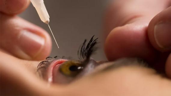 Closeup of an eye looking at a needle preparing to inject medication into the eyeball