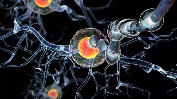 MS nerve cells